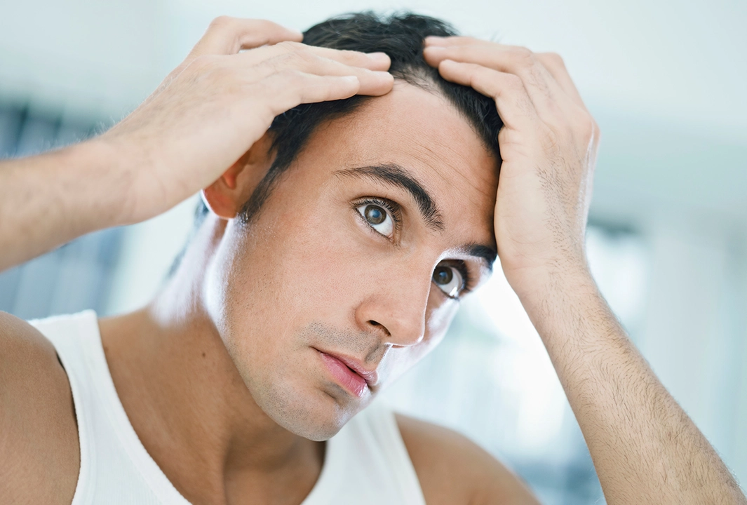 The best hairstyles for men with hair loss to boost their confidence